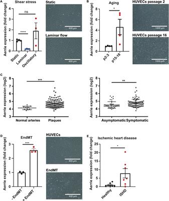 Long Non-coding RNA Aerrie Controls DNA Damage Repair via YBX1 to Maintain Endothelial Cell Function